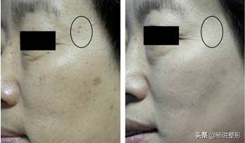 祛斑干货！内服、外调*管双**齐下，具体怎么做？