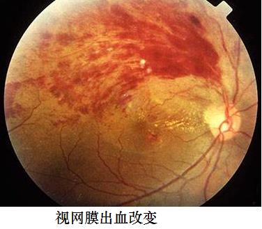 ai眼底照相机检查医院,ai技术落地眼底筛查
