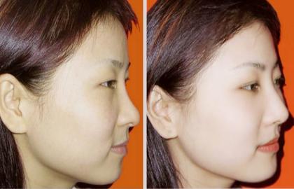 不到100元的保湿面霜,老牌面霜无任何添加剂的有哪几款