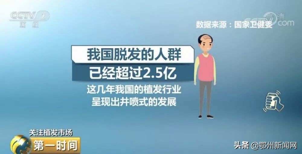 太秃了用什么假发片,秃头怎么办才能防脱发