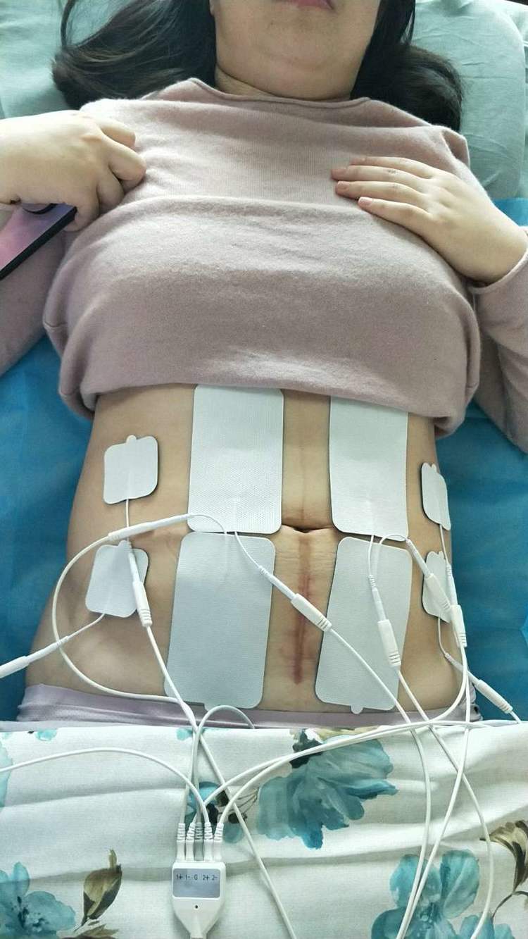 市中心医院产后恢复,新疆自治区中医院预约挂号