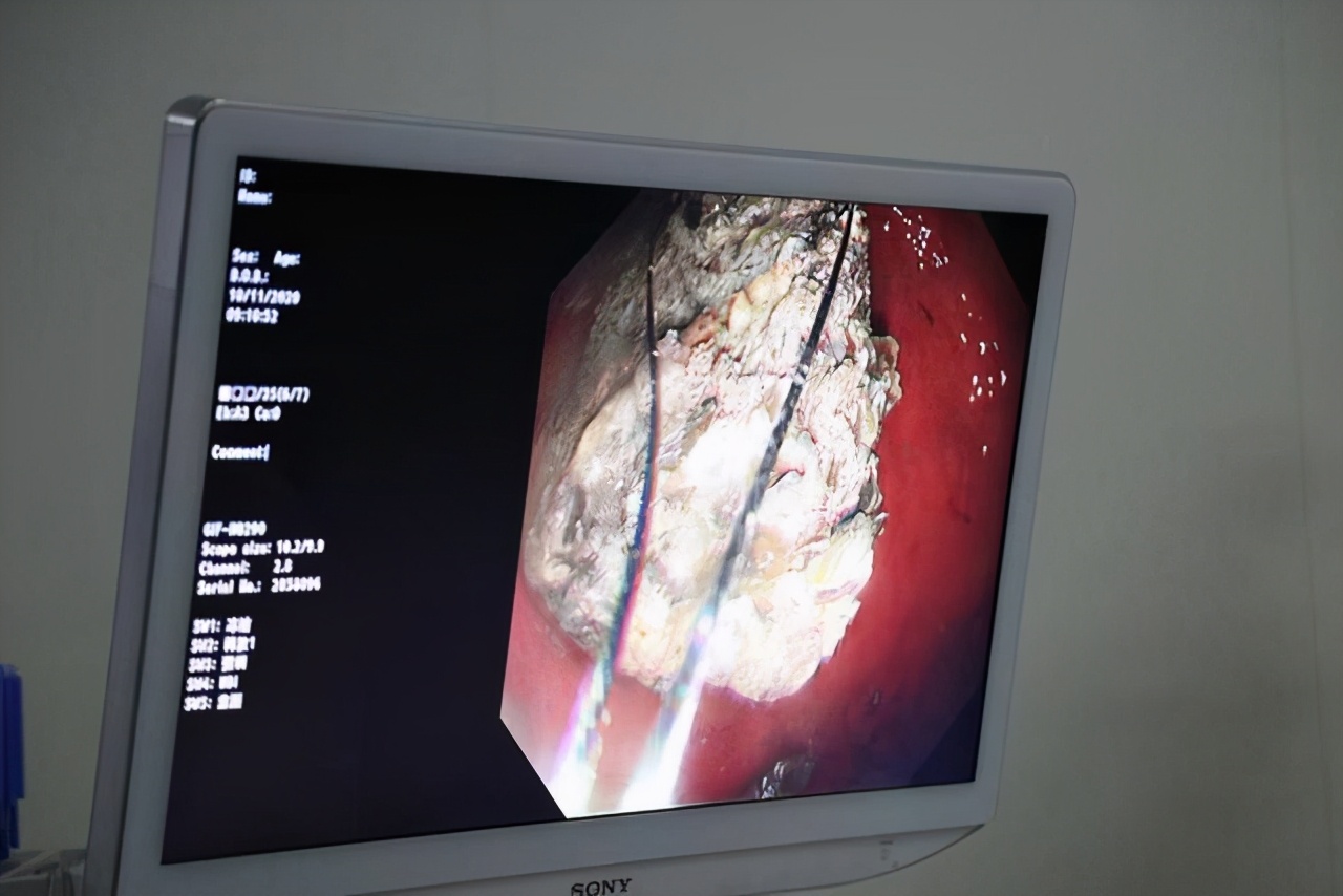 可乐真的可以治病,可乐能治病视频