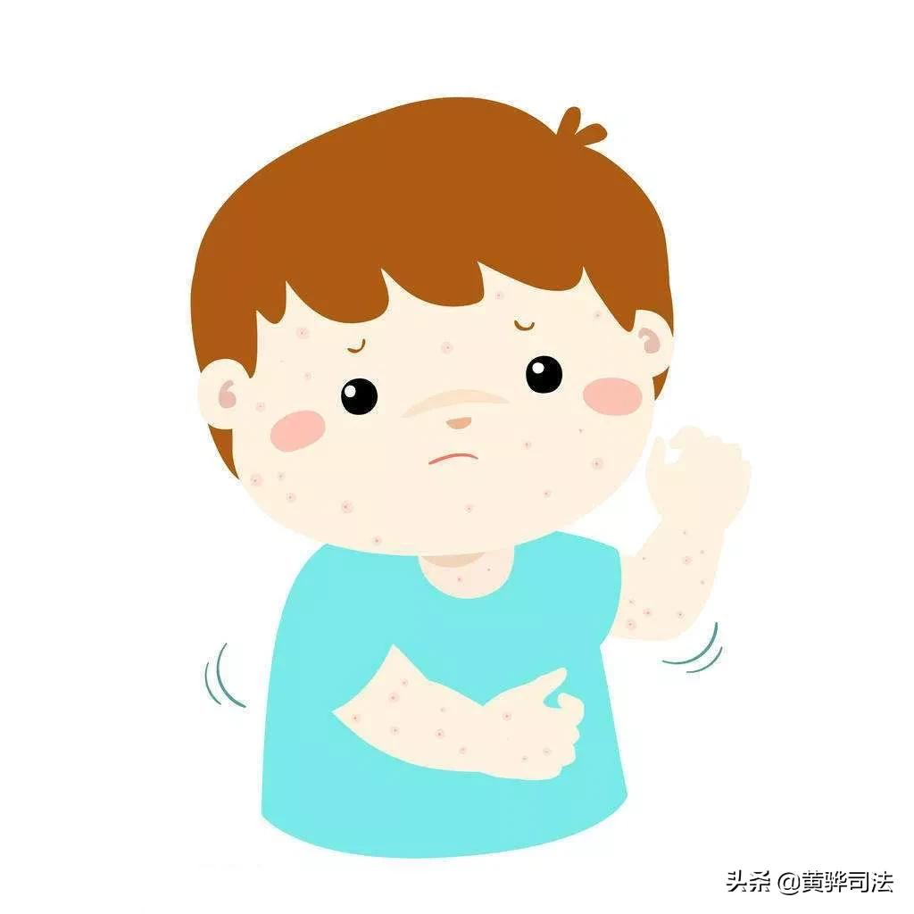 水痘高发季怎样做才能避免中招,水痘高发期预防注意事项