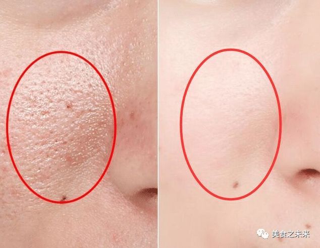 维生素e正确涂脸方法祛痘印,维生素e直接涂在脸上的正确方法