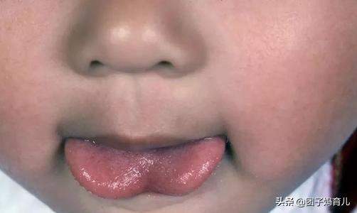 孩子不讲话什么情况下要剪舌根,1岁多孩子剪舌根