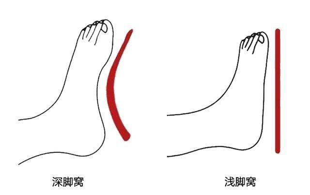 怎样选适合脚型的鞋子,找到一双显脚型好看的鞋子