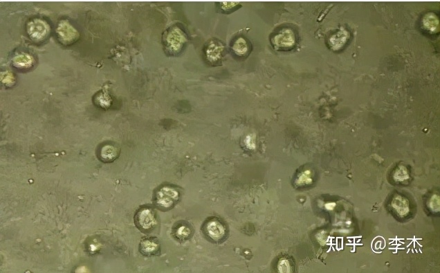细胞被支原体污染怎么处理,细胞培养如何应对支原体污染