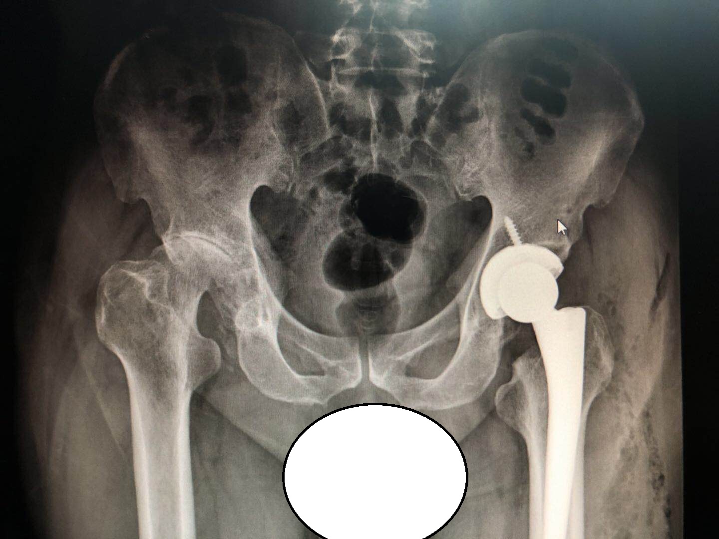 治病只要“头痛医头，脚痛医脚”就可以？这是真的吗？