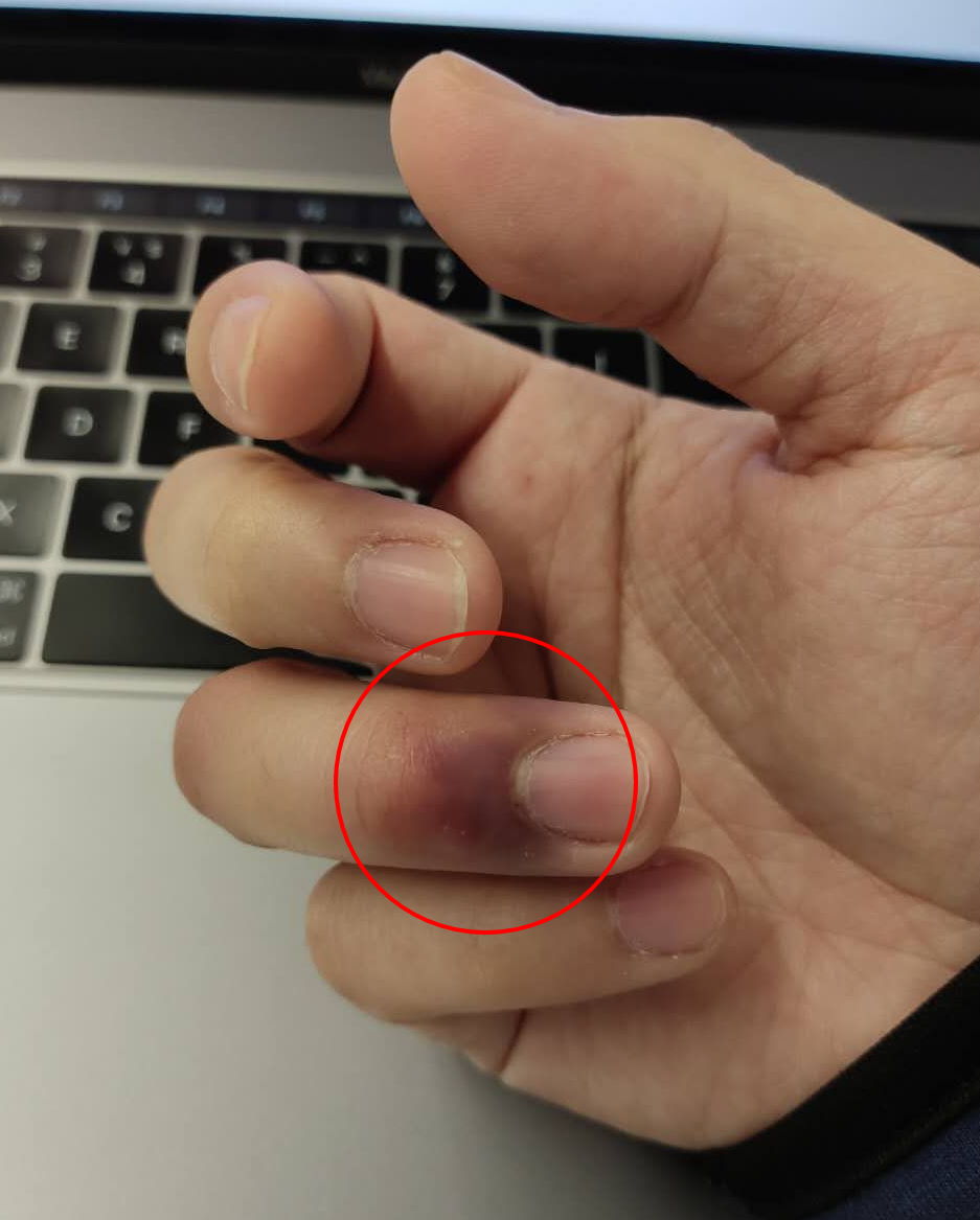 记一次自己心酸的事,记一次心酸的经历