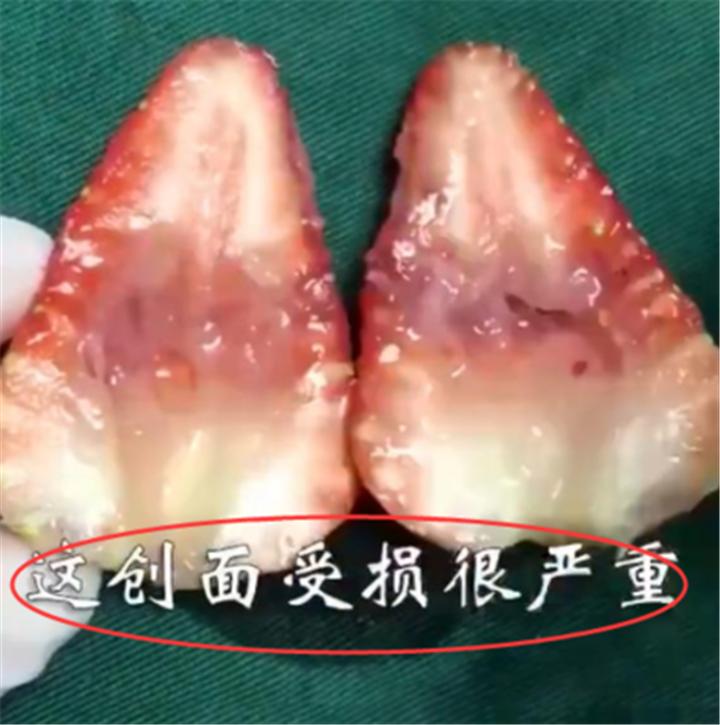 人流的危害科普,人流是不是越年轻伤害越大