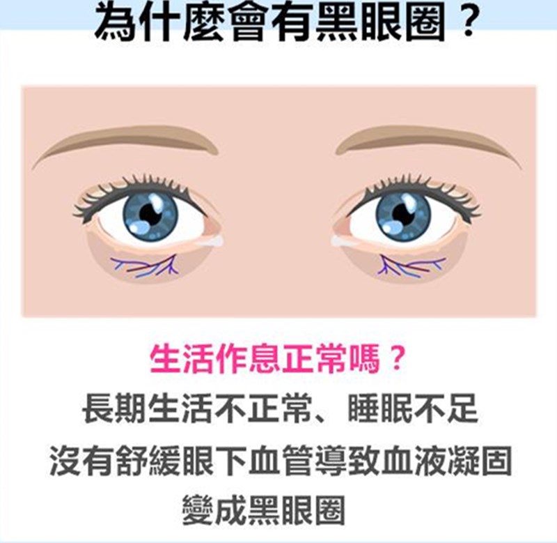 黑眼圈真的只是因为熬夜,熬夜党黑眼圈越来越严重怎么办