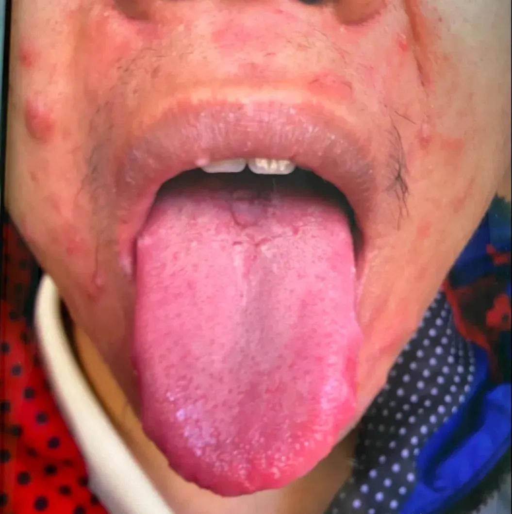 体质寒凉的人怎么调理,体质又寒又热怎么调理