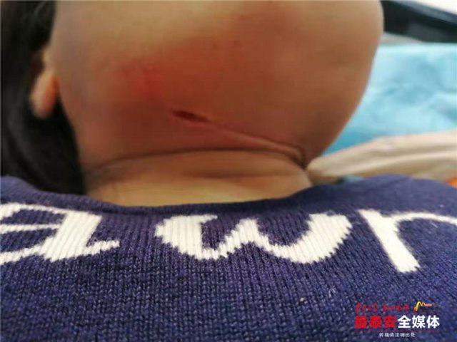 事发*安泰**！女子骑电动被风筝线割伤，割喉伤处缝补30多针