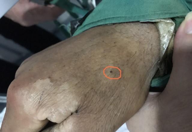 中国海关发现毒蜘蛛,安检发现毒蜘蛛