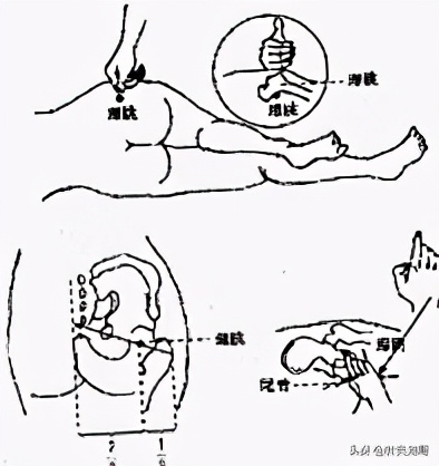 针灸背部穴位学习,针灸只远端取穴效果好吗