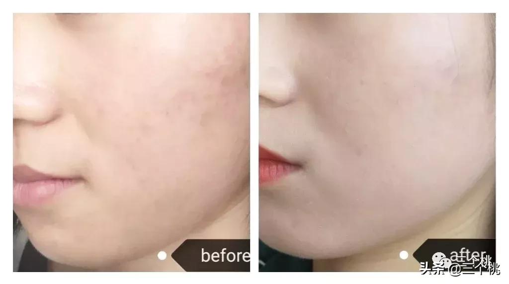 口碑最好十大粉底液夏季,十大公认好用的粉底液及价格