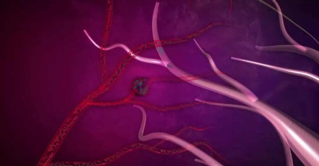 女性如何做好“两癌”筛查一文给你详细指导