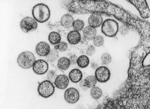 什么是汉坦病毒？人传人吗？可以治愈吗？如何预防呢？死亡率呢？