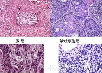 医生辟谣手术,医生辟谣剖腹产出院