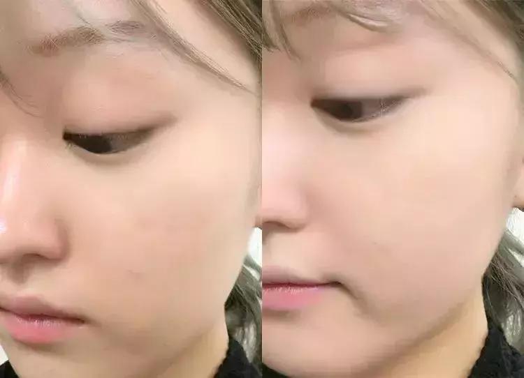 全球最好用的十大气垫,全网最好用气垫排行