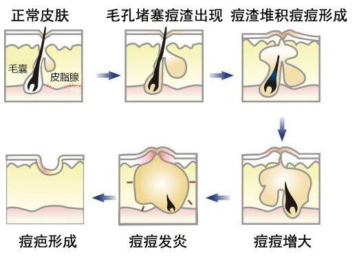 吴昕推荐的洗面奶测评,吴昕同款洗面奶pola