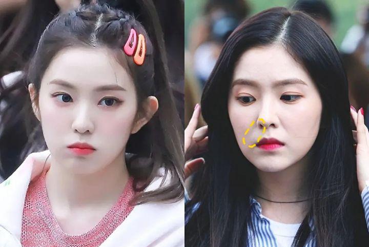 年纪不大为什么会有明显的法令纹,年纪轻轻为什么有很严重的法令纹