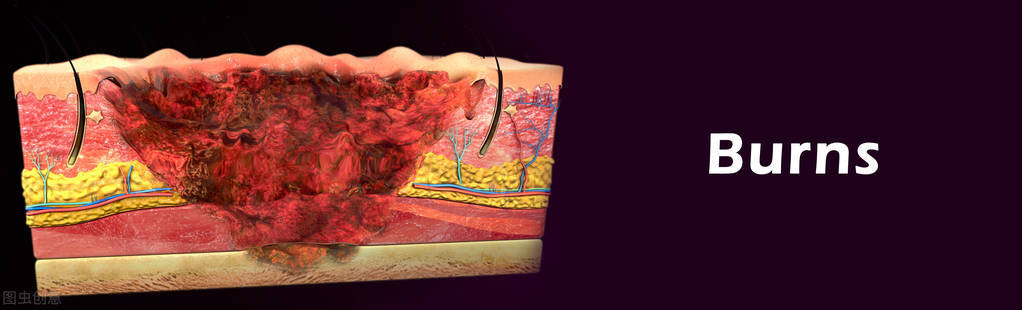 小孩烫伤怎么办6个急救处理方法,儿童烫伤的正确处理方法是什么