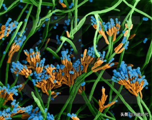 真菌与细菌细胞病毒区别,细菌病毒真菌微生物哪个厉害