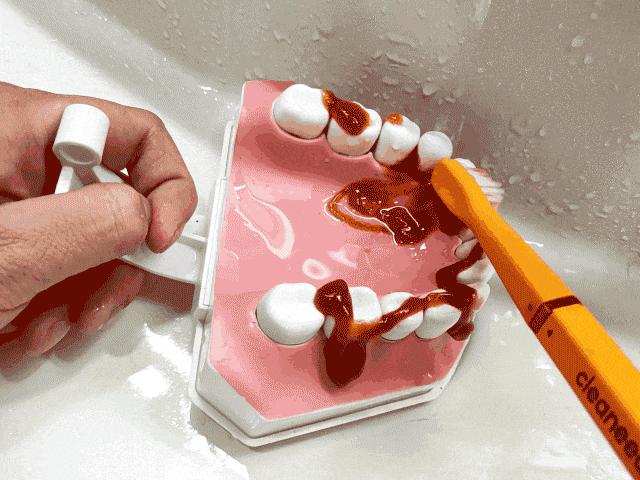 洗牙遭罪不,洗牙难受怎么办