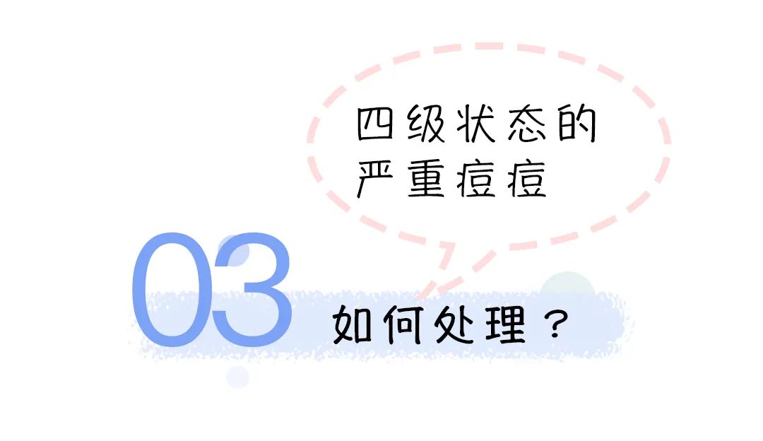 秦岚为它停工8个月险些毁容，姐姐一手烂牌如何打出王炸？
