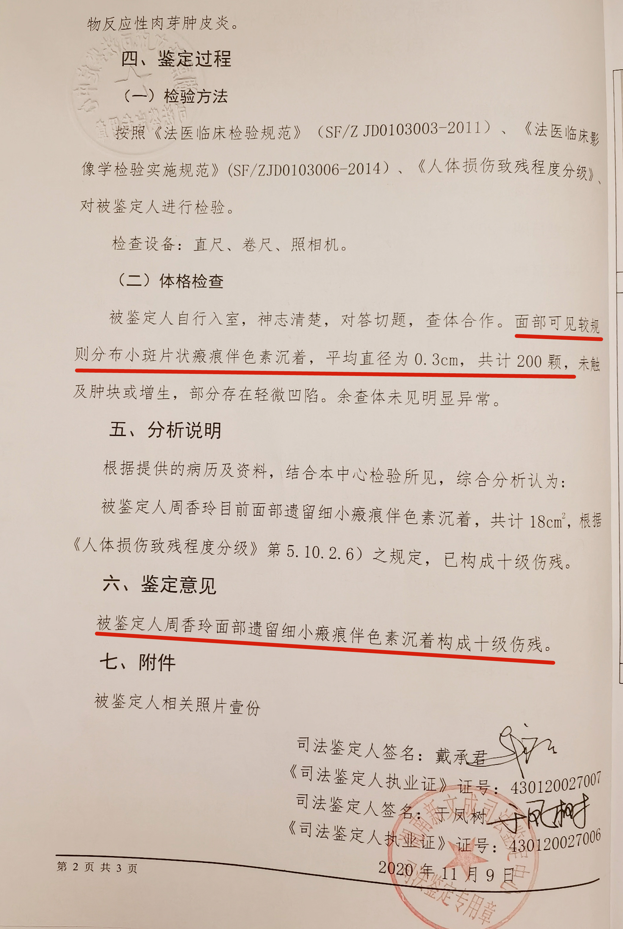 女子注射6针玻尿酸致残案例,女子打水光针致残