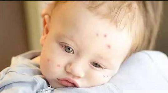 儿童神药骗局,央视禁用的十大儿童药物