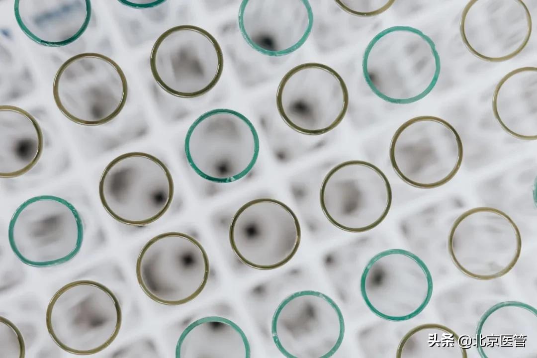 尿液检测报告单未分类,尿液细菌分析报告单要怎么看