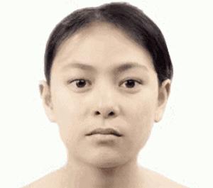 水光针真相大全,水光针一百多块钱是真的假的