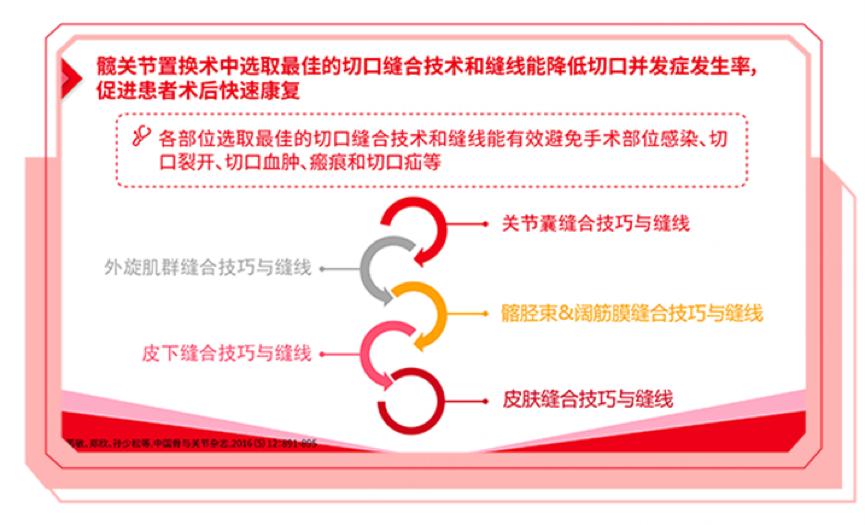 髋关节缝合手术全过程,髋关节置换外表缝合图片