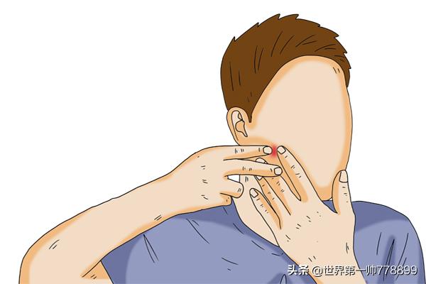 鼻子上挤出来的白色分泌物是什么,鼻子旁边挤出白色的分泌物是什么