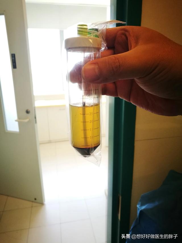 长时间骑自行车手腕疼,骑自行车膝盖上方酸痛是怎么回事