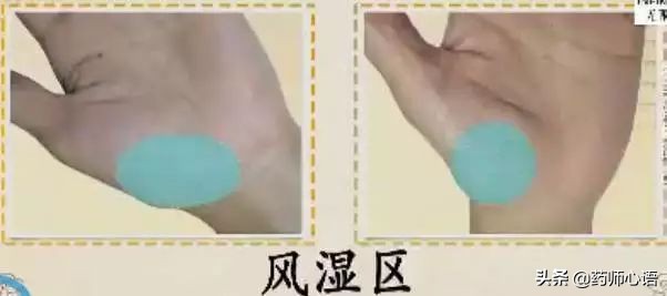 手上的健康秘密,手的颜色能看出健康的问题吗