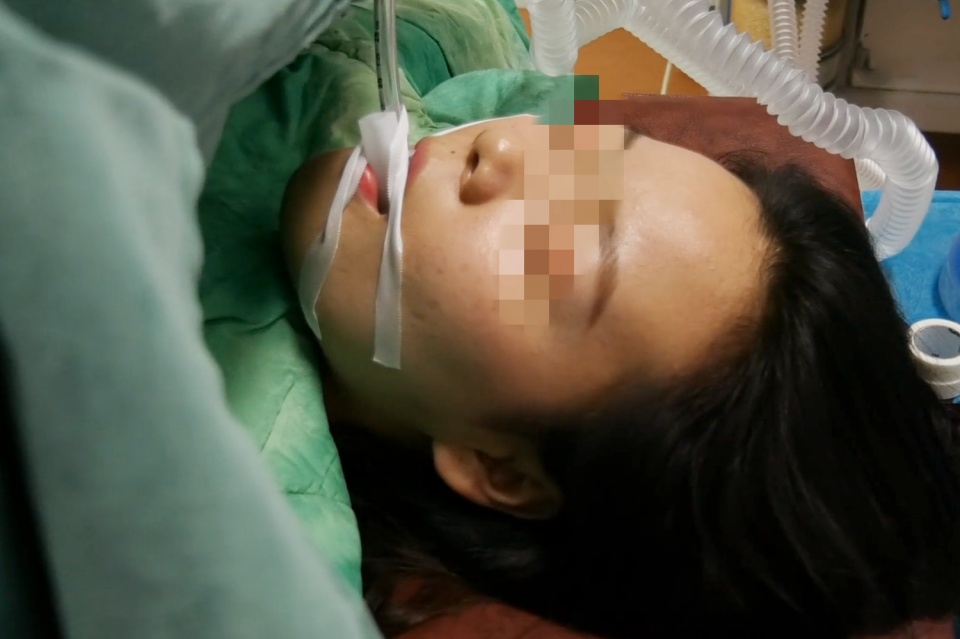 剖腹产手术有多疼,剖腹产术后有多疼