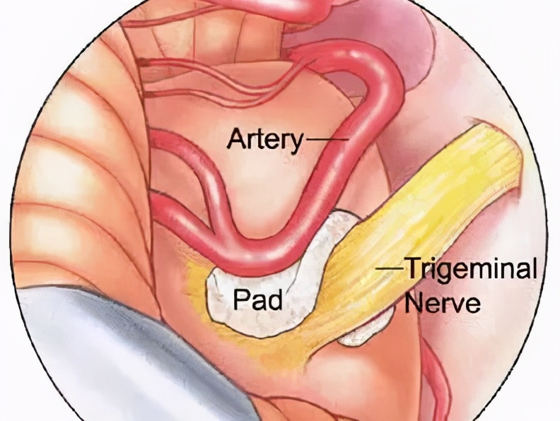 左眼皮跳财右眼跳灾的最全解释,左眼跳财右眼跳灾真相原来是这样