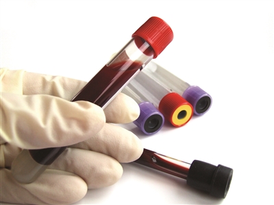 糖化血红蛋白4.8血糖7.2是糖尿病,体检空腹血糖7.1需要复查嘛