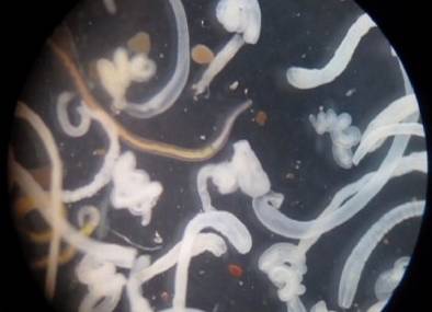 「头条」开水烫三次都杀不死的虫子，不用净水器过滤还能用什么？