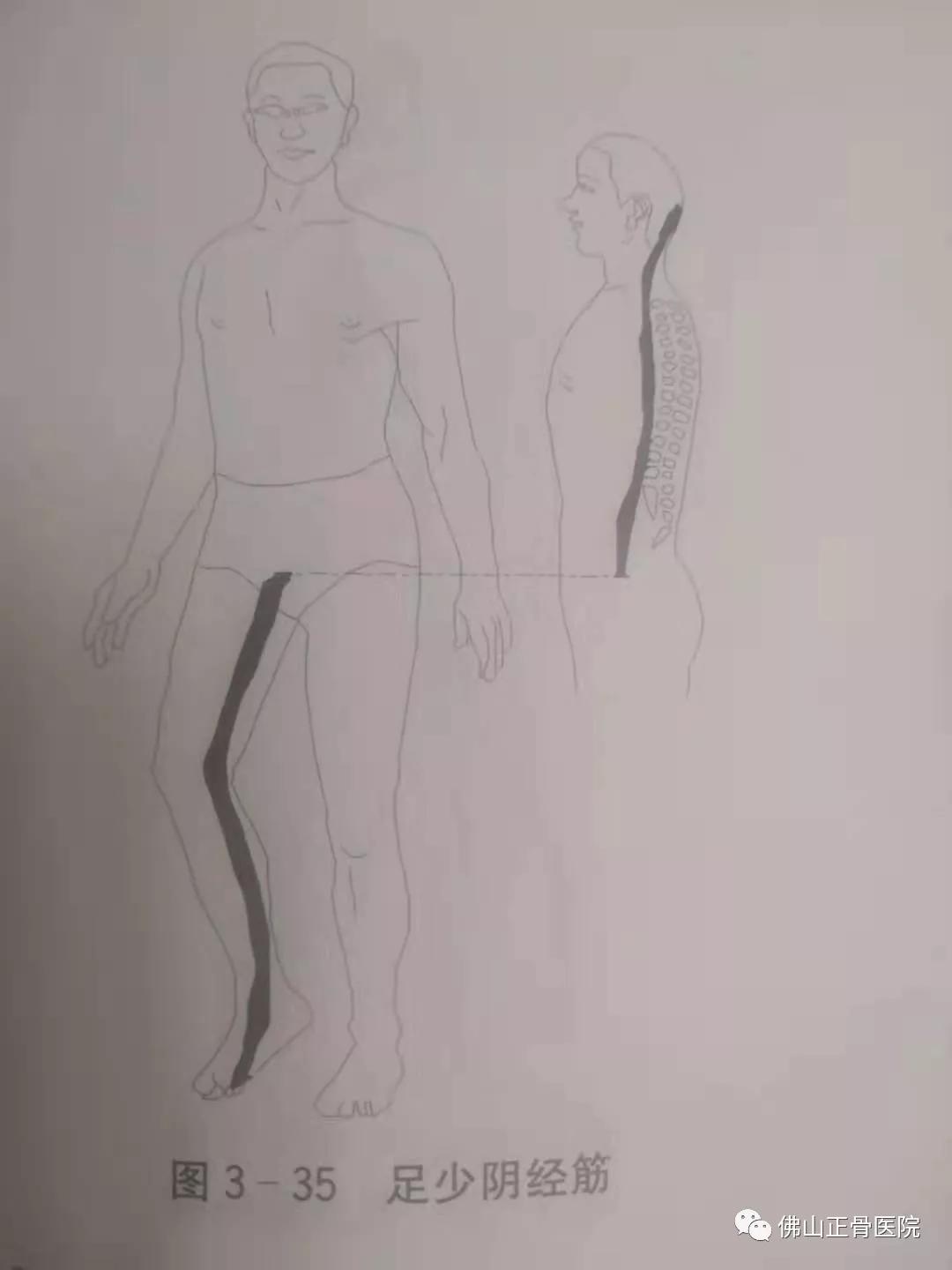 经筋手法，我院名誉院长国医大师韦贵康《韦氏骨伤手法集成》