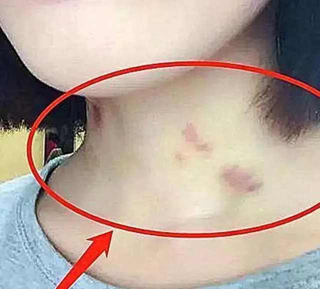 孩子早恋的危害案例,初中孩子早恋的危害及严重后果