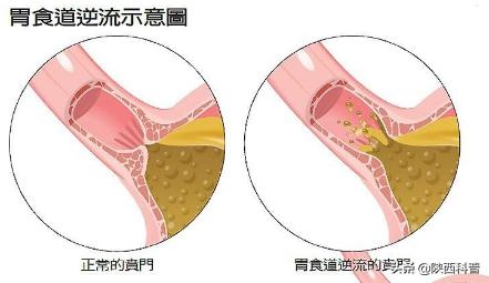 连续打嗝一天怎么办教你一招止嗝,一直打嗝怎么样能止嗝