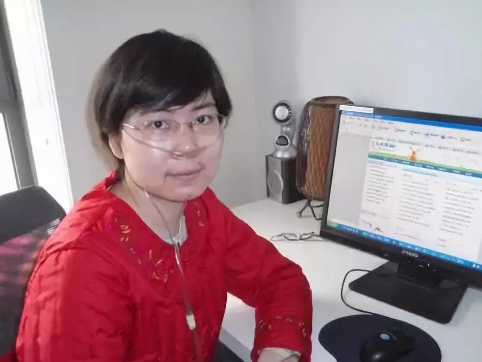 24岁女孩患了一种罕见的病,女性罕见病有哪些症状