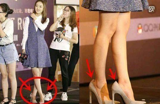 明星的缺陷：范冰冰的屁股，赵丽颖的脚，而她却天生没有子宫