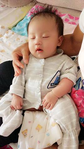 普及!宝宝湿疹不敢用药怕激素?湿疹护理指南来帮你