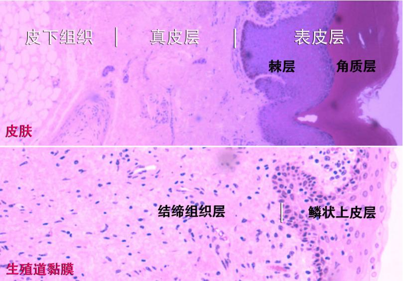 艾滋病毒在体内怎么存活,艾滋病毒在什么条件下存活