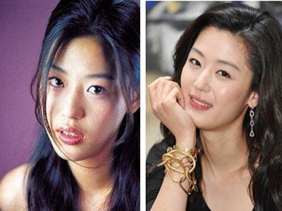 吴宣仪做牙齿前后对比,吴宣仪做整牙